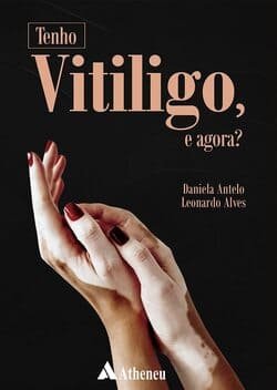 Livros sobre vitiligo na Amazon